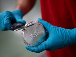 Medalii crăpate la Jocurile Olimpice Milano-Cortina: organizatorii confirmă și investighează problema